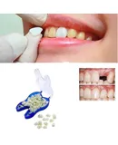 Temporary Tooth Repair Kit Teeth And Gaps Teeth Teeth Whitening Tooth Front Teeth