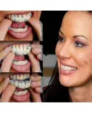 A Pair Upper Lower Denture Instant Smile Comfort Fit Flex Cosmetic Teeth Denture Teeth Top Cosmetic Veneer_k05 EAN 9191174146142