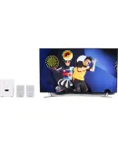 UGREEN 3.5mm Female to Dual RCA Male Audio Cable, 2RCA Red And White Audio Cable, One-To Connection Cable, Phone Computer to Speaker Amplifier Adapter Cable, 10561