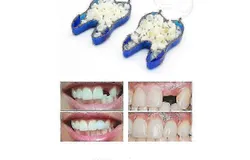 Temporary Denture Braces Occlude Upper Dentures Veneer Dentures Missing Teeth Broken Teeth_B