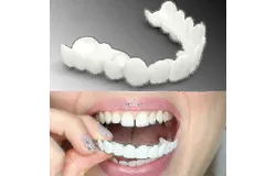 Whitening Denture Braces&lpar;Lower teeth&rpar;