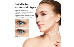 EELHOE 20PCS&sol; Bottle Protein Thread Lifting Line Anti-Aging Anti-wrinkles Pore Replenish Moisturing Skin Elasticity Refining for Home Daily Salon Use
