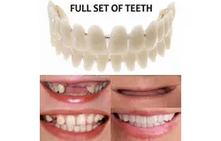 Smile Snap On False Teeth Upper Lower Dental Veneers Dentures Tooth Cover Set Linglai-hy