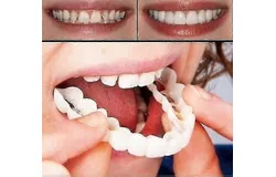 A pair of upper and lower high-quality dentures for an instant smile